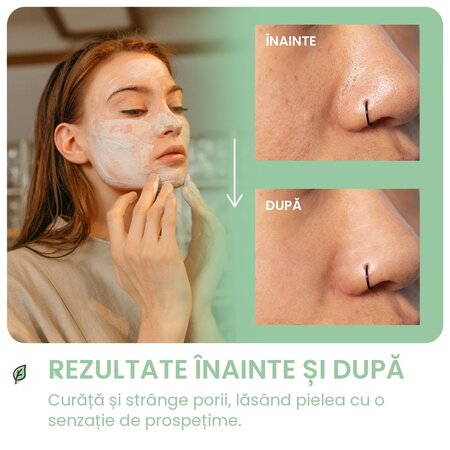 Stick pentru cosuri si imperfectiuni Blemish & Spot Stick, 40 g, Breakout+Aid 750466