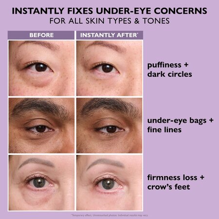 Tratament pentru ochi Instant Firmx Eye, 20 ml, Peter Thomas Roth 753209