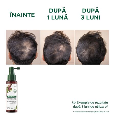 Ser cu chinina si floare de colt BIO, 100 ml, Klorane 671998