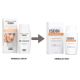 Crema de fata cu protectie solara SPF50+ PA++++ Spot Prevent, 50 ml, Isdin 657347