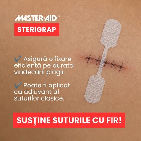 Plasture pentru suturarea ranii Sterigrap Master-Aid, 32 x 8 mm, 10 bucati, Pietrasanta Pharma 743953