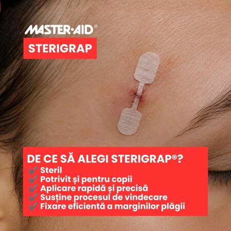 Plasture pentru suturarea ranii Sterigrap Master-Aid, 32 x 8 mm, 10 bucati, Pietrasanta Pharma 743954