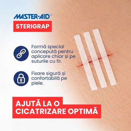 Plasture pentru sututarea ranii Sterigrap Master-Aid, 100 x 12 mm, 6 bucati, Pietrasanta Pharma 743956