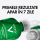 Serum anti-imperfectiuni Probio-BHA pentru ten gras cu tendinta acneica Normaderm, 30 ml, Vichy 599754