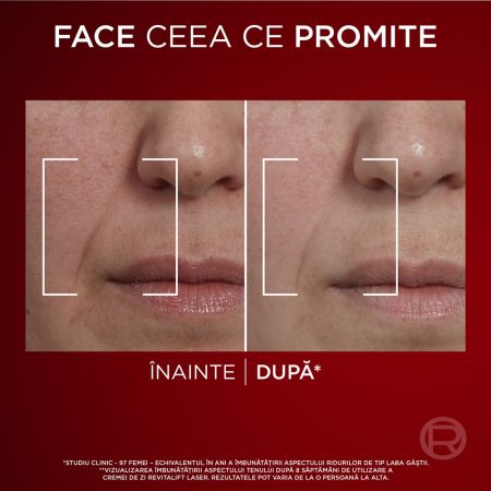 Crema antirid de zi cu tripla actiune Revitalift Laser, 50 ml, Loreal 660572