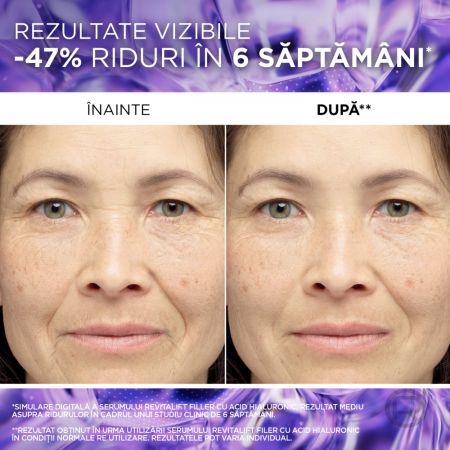 Ser antirid cu 1.5% acid hialuronic pur Revitalift Filler, 30 ml, Loreal 696075