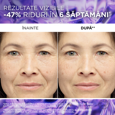 Ser antirid cu 1.5% acid hialuronic pur Revitalift Filler, 30 ml, Loreal 696075