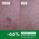 Fluid cu textura apoasa anti-imperfectiuni cu protectie solara SPF 50+ Capital Soleil UV Clear, 40 ml, Vichy 739749