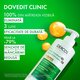 Sampon antimatreata pentru par normal spre gras si scalp cu senzatie de mancarime Dercos, 390 ml, Vichy 748049