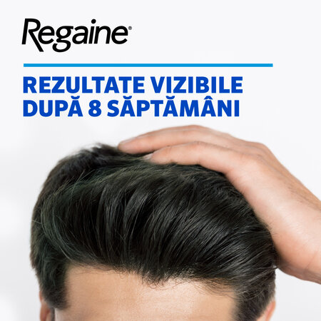Regaine spuma impotriva caderii parului la barbati, 60 g, Johnson Johnson 751386