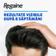 Regaine spuma impotriva caderii parului la barbati, 60 g, Johnson Johnson 751386