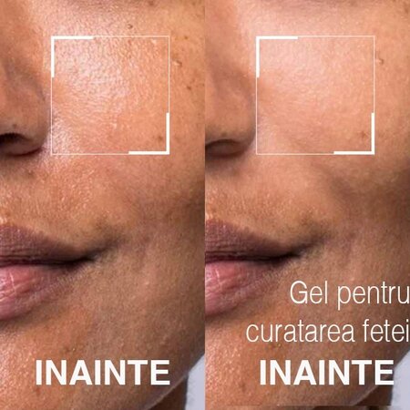 Gel pentru curatarea fetei No More Pore, 105 ml, Dr. Brandt 610541