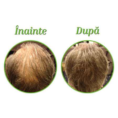 Fibre naturale de keratina pentru densificarea parului Dark Blond, 12,5 g, The Cosmetic Republic