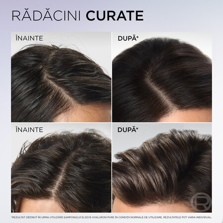 Balsam rehidratant pentru scalp si radacini grase si lungimi deshidratate Hyaluron Pure, 200 ml, Elseve 695989