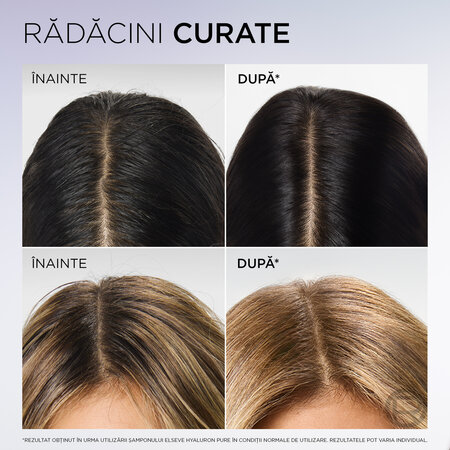 Balsam rehidratant pentru scalp si radacini grase si lungimi deshidratate Hyaluron Pure, 200 ml, Elseve 695988