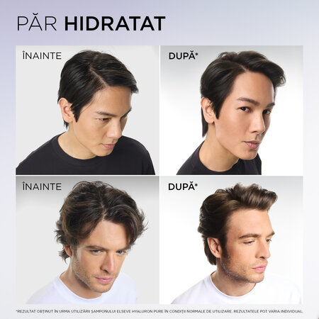 Sampon purificator pentru scalp si radacini grase si lungimi deshidratate Hyaluron Pure, 250 ml, Elseve 696005
