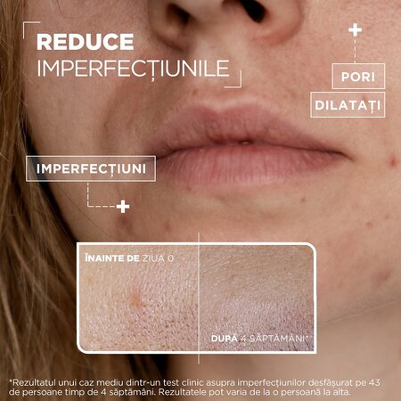 Serum anti-imperfectiuni Anti Imperfection, 30 ml, Mixa 602234