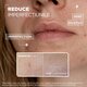 Serum anti-imperfectiuni Anti Imperfection, 30 ml, Mixa 602234