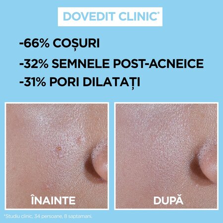 Crema fluida invizibila anti-imperfectiuni cu SPF 50+ Pure Active, 40 ml, Garnier 602253