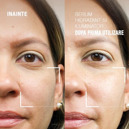 Serum hidratant si iluminator Dr. B. Lab., 30 ml, Dr. Brandt 606153