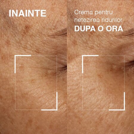 Crema pentru netezirea ridurilor Needles No More, 15 ml, Dr. Brandt 606110