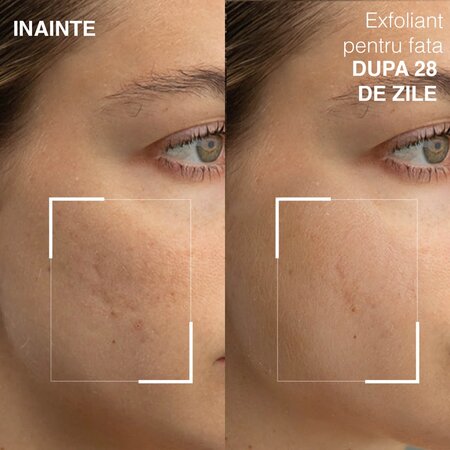 Exfoliant pentru fata Renewing Face Exfoliator, 60 ml, Dr. Brandt 606095