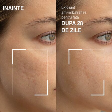 Exfoliant anti-imbatranire pentru fata Age-Defying Exfoliator, 20 ml, Dr. Brandt 606075