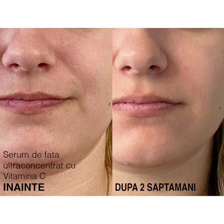 Serum de fata ultraconcentrat cu Vitamina C Scription, 30 ml, Dr. Brandt 610525